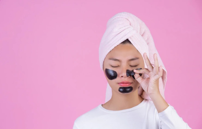 Blackheads
