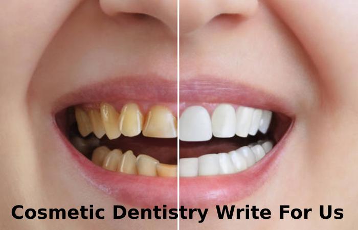 Cosmetic Dentistry Write For Us