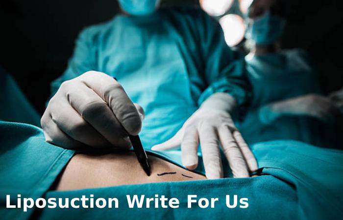 Liposuction Write For Us