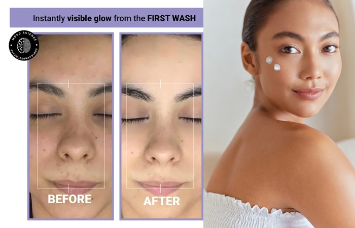 Benefits of Using Cetaphil Cleanser