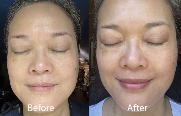 dermatouch face wash results timeline before after